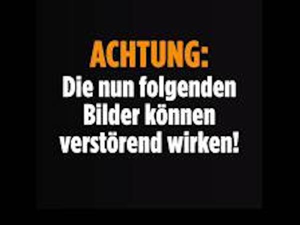 Notfall (Achtung schlimme Bilder)